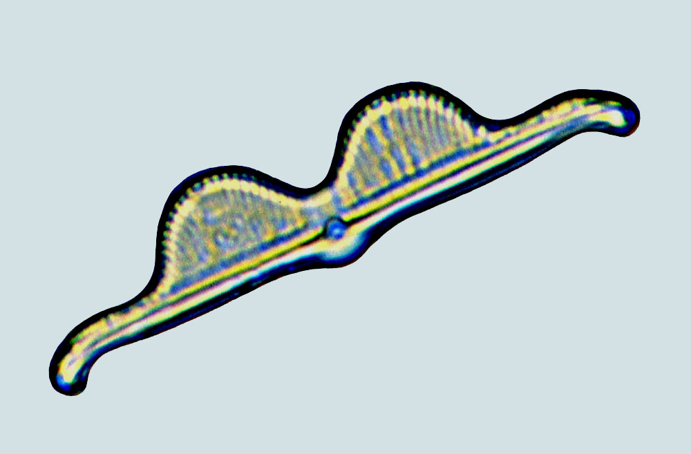 Amcadifa Amphora bigibba